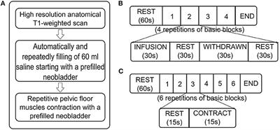 Neuroimaging Study Investigating the Supraspinal Control of Lower Urinary Tract Function in Man With Orthotopic Ileal Neobladder